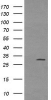 TPSG1 / Tryptase Gamma 1 Antibody - HEK293T cells were transfected with the pCMV6-ENTRY control (Left lane) or pCMV6-ENTRY TPSG1 (Right lane) cDNA for 48 hrs and lysed. Equivalent amounts of cell lysates (5 ug per lane) were separated by SDS-PAGE and immunoblotted with anti-TPSG1.