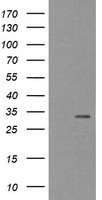 TPSG1 / Tryptase Gamma 1 Antibody - HEK293T cells were transfected with the pCMV6-ENTRY control (Left lane) or pCMV6-ENTRY TPSG1 (Right lane) cDNA for 48 hrs and lysed. Equivalent amounts of cell lysates (5 ug per lane) were separated by SDS-PAGE and immunoblotted with anti-TPSG1.