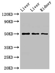 TPST1 Antibody - Positive WB detected in:Rat liver tissue,Mouse liver tissue,Mouse kidney tissue;All lanes:TPST1 antibody at 2.4?g/ml;Secondary;Goat polyclonal to rabbit IgG at 1/50000 dilution;Predicted band size: 43 KDa;Observed band size: 50 KDa;