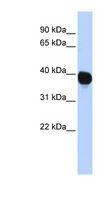 TPST2 Antibody - TPST2 antibody Western blot of HepG2 cell lysate. This image was taken for the unconjugated form of this product. Other forms have not been tested.