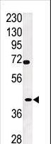 TPST2 Antibody - Western blot of anti-TPST2 antibody in A2058 cell line lysate (35 ug/lane). TPST2(arrow) was detected using the purified antibody.