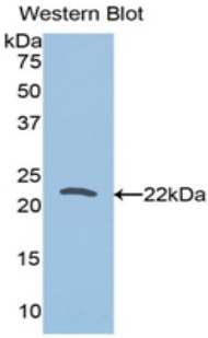TPT1 / TCTP Antibody - Western blot of recombinant TPT1 / TCTP.  This image was taken for the unconjugated form of this product. Other forms have not been tested.