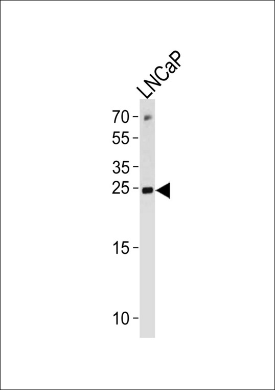 TPT1 / TCTP Antibody - TPT1 Antibody western blot of LNCaP cell line lysates (35 ug/lane). The TPT1 antibody detected the TPT1 protein (arrow).