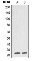 TPT1 / TCTP Antibody - Western blot analysis of TCTP expression in DU145 (A); CCRFCEM (B) whole cell lysates.
