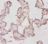 TPT1 / TCTP Antibody - Immunohistochemistry of paraffin-embedded human placenta tissue using Tpt1 Antibody at dilution of 1:20