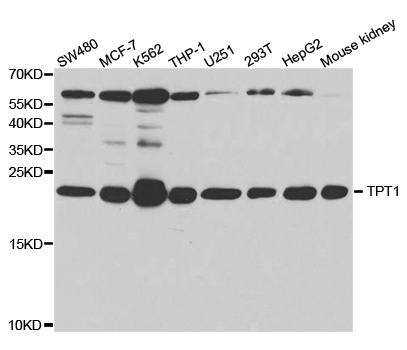 TPT1 / TCTP Antibody - Western blot analysis of extracts of various cell lines.