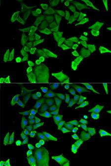 TPT1 / TCTP Antibody - Immunofluorescence analysis of HeLa cells.