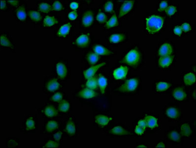 TPT1 / TCTP Antibody - Immunofluorescence staining of Hela cells with TPT1 Antibody at 1:100, counter-stained with DAPI. The cells were fixed in 4% formaldehyde, permeabilized using 0.2% Triton X-100 and blocked in 10% normal Goat Serum. The cells were then incubated with the antibody overnight at 4°C. The secondary antibody was Alexa Fluor 488-congugated AffiniPure Goat Anti-Rabbit IgG(H+L).