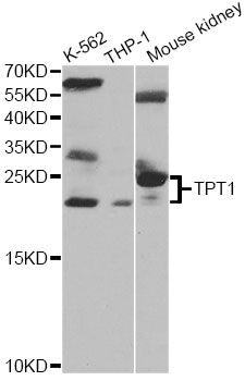 TPT1 / TCTP Antibody - Western blot analysis of extracts of various cell lines, using TPT1 antibody at 1:1000 dilution. The secondary antibody used was an HRP Goat Anti-Rabbit IgG (H+L) at 1:10000 dilution. Lysates were loaded 25ug per lane and 3% nonfat dry milk in TBST was used for blocking.
