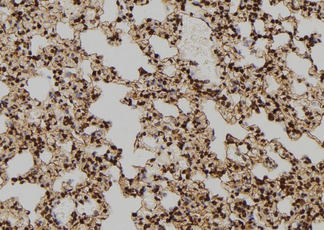 TPT1 / TCTP Antibody - 1:100 staining rat lung tissue by IHC-P. The sample was formaldehyde fixed and a heat mediated antigen retrieval step in citrate buffer was performed. The sample was then blocked and incubated with the antibody for 1.5 hours at 22°C. An HRP conjugated goat anti-rabbit antibody was used as the secondary.