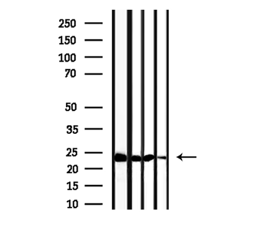 TPT1 / TCTP Antibody - Western blot analysis of extracts of 293, HeLa, mouse brain and rat muscle using TPT1 antibody.