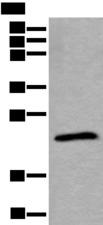 TPT1 / TCTP Antibody - Western blot analysis of Jurkat cell lysate  using TPT1 Polyclonal Antibody at dilution of 1:800