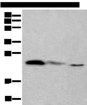 TPT1 / TCTP Antibody - Western blot analysis of 293T and Hela cell lysates  using TPT1 Polyclonal Antibody at dilution of 1:450