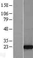 TPT1 / TCTP Protein - Western validation with an anti-DDK antibody * L: Control HEK293 lysate R: Over-expression lysate