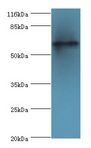 TPTE Antibody - Western blot. All lanes: TPTE antibody at 2 ug/ml+HepG2 whole cell lysate. Secondary antibody: goat polyclonal to rabbit at 1:10000 dilution. Predicted band size: 64 kDa. Observed band size: 64 kDa.  This image was taken for the unconjugated form of this product. Other forms have not been tested.