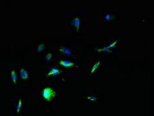 TPTE Antibody - Immunofluorescent analysis of HepG2 cells using TPTE Antibody at dilution of 1:100 and Alexa Fluor 488-congugated AffiniPure Goat Anti-Rabbit IgG(H+L)