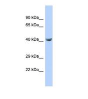TPTE Antibody - Western blot of Human 721_B. TPTE antibody dilution 1.0 ug/ml.  This image was taken for the unconjugated form of this product. Other forms have not been tested.