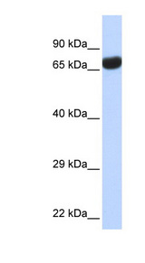 TPTE Antibody - TPTE antibody Western blot of Fetal lung lysate. This image was taken for the unconjugated form of this product. Other forms have not been tested.