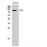 TPX2 Antibody - Western blot of TPX2 antibody