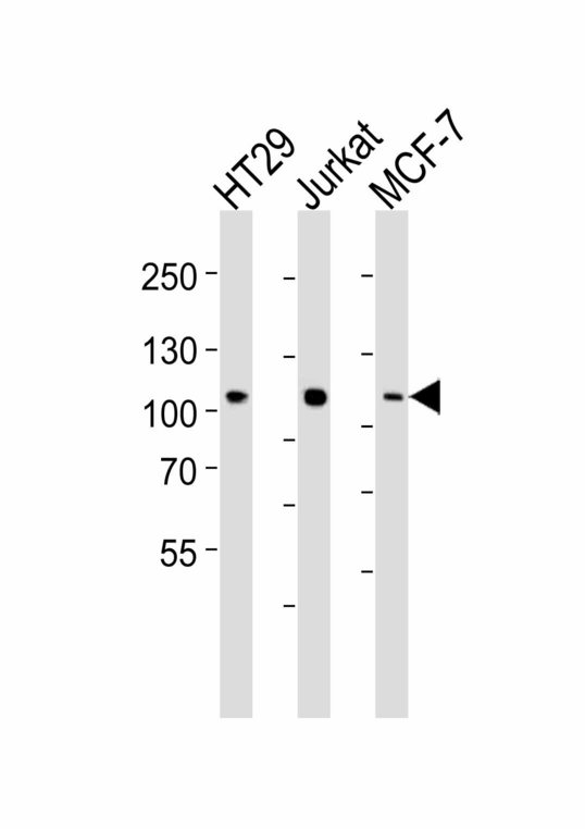 TPX2 Antibody - Western blot of lysates from HT29, Jurkat, MCF-7 cell line (from left to right), using P100 Antibody(19AT953. 286. 93). 19AT953. 286. 93 was diluted at 1:1000 at each lane. A goat anti-mouse IgG H&L (HRP) at 1:3000 dilution was used as the secondary antibody. Lysates at 35ug per lane.
