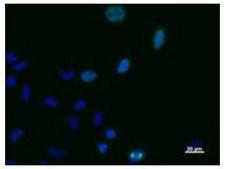 TPX2 Antibody - Immunofluorescent staining using TPX2 antibody. Immunostaining analysis in HeLa cells. HeLa cells were fixed with 4% paraformaldehyde and permeabilized with 0.01% Triton-X100 in PBS. The cells were immunostained with anti-TPX2 antibody. Nuclear was stained with Hoechst (blue fluorescence).