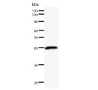 TPX2 Antibody - Western blot analysis of immunized recombinant protein, using anti-TPX2 monoclonal antibody.