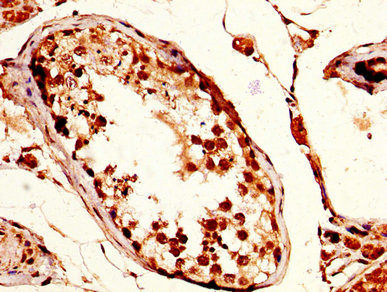 TPX2 Antibody - Immunohistochemistry image at a dilution of 1:200 and staining in paraffin-embedded human testis tissue performed on a Leica BondTM system. After dewaxing and hydration, antigen retrieval was mediated by high pressure in a citrate buffer (pH 6.0) . Section was blocked with 10% normal goat serum 30min at RT. Then primary antibody (1% BSA) was incubated at 4 °C overnight. The primary is detected by a biotinylated secondary antibody and visualized using an HRP conjugated SP system.