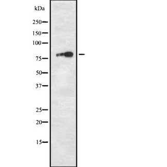 TPX2 Antibody - Western blot analysis of DIL-2 using RAW264.7 whole cells lysates