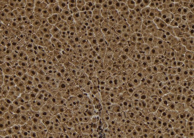 TPX2 Antibody - 1:100 staining rat liver tissue by IHC-P. The sample was formaldehyde fixed and a heat mediated antigen retrieval step in citrate buffer was performed. The sample was then blocked and incubated with the antibody for 1.5 hours at 22°C. An HRP conjugated goat anti-rabbit antibody was used as the secondary.
