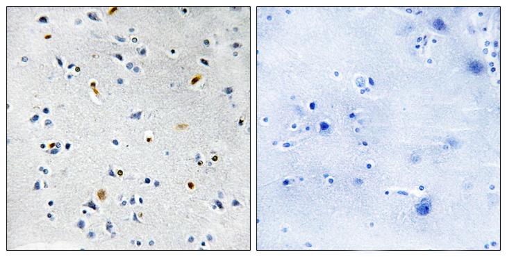 TPX2 Antibody - Peptide - + Immunohistochemistry analysis of paraffin-embedded human brain tissue using DIL-2 antibody.