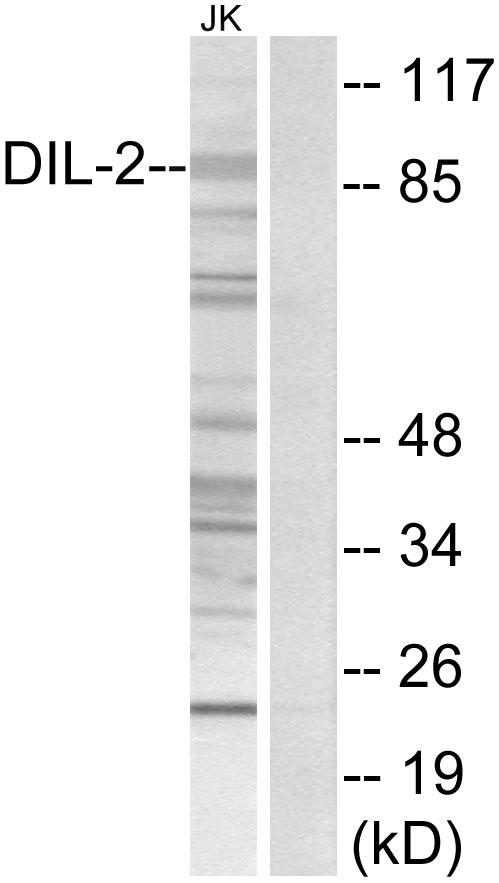 TPX2 Antibody - Western blot analysis of extracts from Jurkat cells, using DIL-2 antibody.