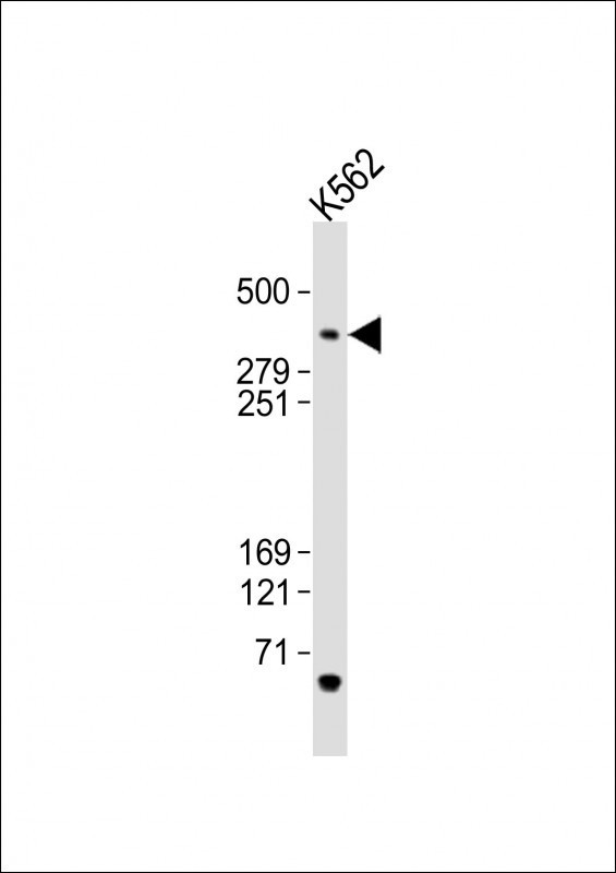Tra1 / TRRAP Antibody - Anti-TRRAP Antibody (C-term)at 1:2000 dilution + K562 whole cell lysates Lysates/proteins at 20 ug per lane. Secondary Goat Anti-Rabbit IgG, (H+L), Peroxidase conjugated at 1:10000 dilution. Predicted band size: 438 kDa. Blocking/Dilution buffer: 5% NFDM/TBST.