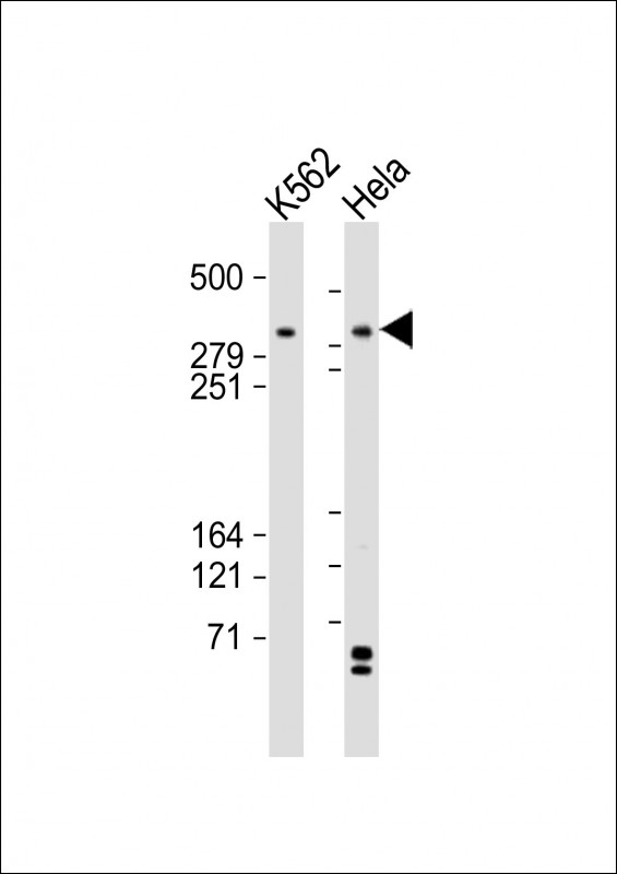 Tra1 / TRRAP Antibody - All lanes: Anti-TRRAP Antibody (C-term) at 1:2000 dilution. Lane 1: K562 whole cell lysates. Lane 2: HeLa whole cell lysates Lysates/proteins at 20 ug per lane. Secondary Goat Anti-Rabbit IgG, (H+L), Peroxidase conjugated at 1:10000 dilution. Predicted band size: 438 kDa. Blocking/Dilution buffer: 5% NFDM/TBST.