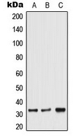 TRA2A Antibody - Western blot analysis of TRA2A expression in HeLa (A); Jurkat (B); 129Sv (C) whole cell lysates.
