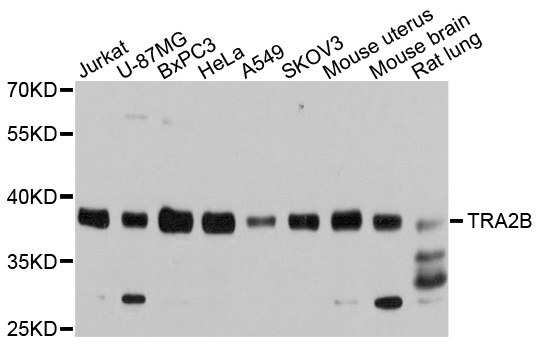 TRA2B / SFRS10 Antibody - Western blot analysis of extracts of various cell lines.