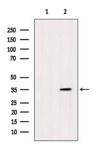 TRA2B / SFRS10 Antibody