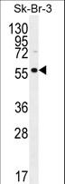 TRABD2A / C2orf89 Antibody - LOC129293 Antibody western blot of SK-BR-3 cell line lysates (35 ug/lane). The LOC129293 antibody detected the LOC129293 protein (arrow).
