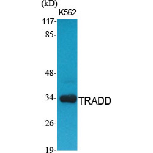 TRADD Antibody - Western blot of TRADD antibody