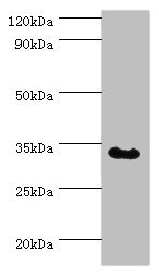 TRADD Antibody - Western blot All lanes: Tumor necrosis factor receptor type 1-associated DEATH domain protein antibody at 12µg/ml + MCF-7 whole cell lysate Secondary Goat polyclonal to rabbit IgG at 1/10000 dilution Predicted band size: 35, 28 kDa Observed band size: 35 kDa