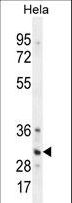 TRADD Antibody - TRADD Antibody western blot of HeLa cell line lysates (35 ug/lane). The TRADD antibody detected the TRADD protein (arrow).