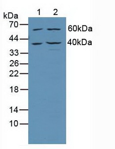 TRADD Antibody - Western Blot; Sample: Lane1: Human Jurkat Cells; Lane2: Human Hela Cells.
