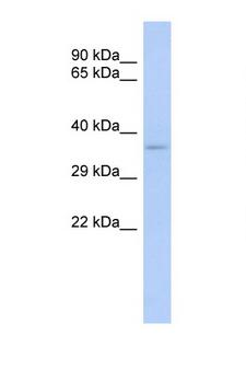 TRADD Antibody - TRADD antibody Western blot of DU145 Cell lysate. Antibody concentration 1 ug/ml. This image was taken for the unconjugated form of this product. Other forms have not been tested.