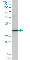TRADD Antibody - TRADD monoclonal antibody (M01), clone 3G1. Western blot of TRADD expression in HeLa NE.