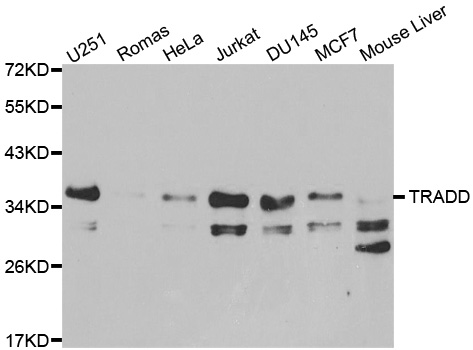 TRADD Antibody - Western blot analysis of extracts of various cell lines.