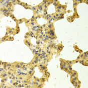 TRADD Antibody - Immunohistochemistry of paraffin-embedded rat lung tissue.