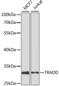 TRADD Antibody - Western blot analysis of extracts of various cell lines, using TRADD antibody at 1:1000 dilution. The secondary antibody used was an HRP Goat Anti-Rabbit IgG (H+L) at 1:10000 dilution. Lysates were loaded 25ug per lane and 3% nonfat dry milk in TBST was used for blocking. An ECL Kit was used for detection and the exposure time was 10s.