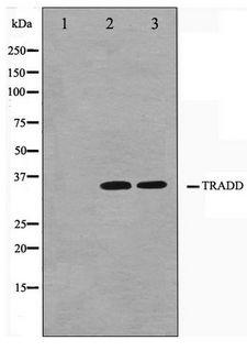 TRADD Antibody - Western blot of COS7 and HUVEC cell lysate using TRADD Antibody
