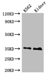 TRADD Antibody - Positive WB detected in:K562 whole cell lysate,Rat kidney tissue;All lanes:TRADD antibody at 4?g/ml;Secondary;Goat polyclonal to rabbit IgG at 1/50000 dilution;Predicted band size: 35,28 KDa;Observed band size: 35 KDa;