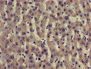 TRADD Antibody - Immunohistochemistry of paraffin-embedded human liver tissue using TRADD Antibody at dilution of 1:100