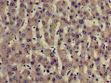 TRADD Antibody - Immunohistochemistry of paraffin-embedded human liver tissue using TRADD Antibody at dilution of 1:100